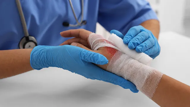 A close-up shot of a healthcare provider wearing blue scrubs and gloves gently wrapping a white gauze bandage around a patient's injured, reddened hand.